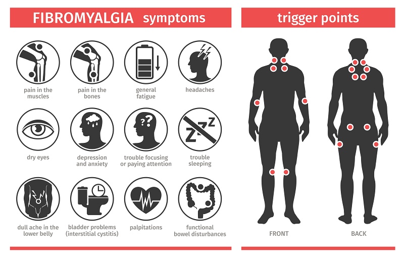 fibromyalgia chart of symptoms